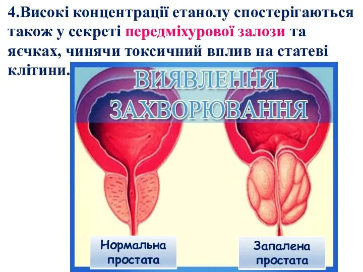 4.Високі концентрації етанолу спостерігаються також у секреті передміхурової залози та