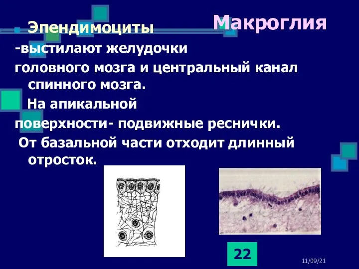 11/09/21 Макроглия Эпендимоциты -выстилают желудочки головного мозга и центральный канал