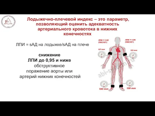 Лодыжечно-плечевой индекс – это параметр, позволяющий оценить адекватность артериального кровотока