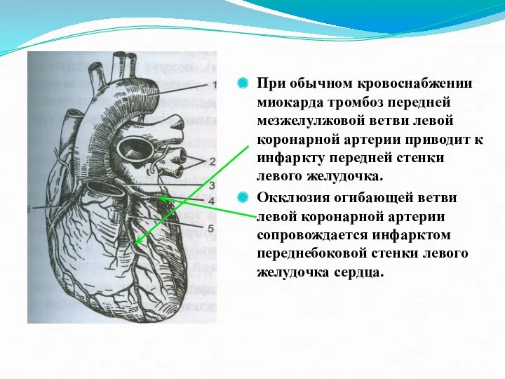 При обычном кровоснабжении миокарда тромбоз передней мезжелулжовой ветви левой коронарной