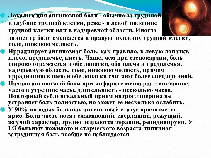 Локализация ангинозной боли - обычно за грудиной в глубине грудной