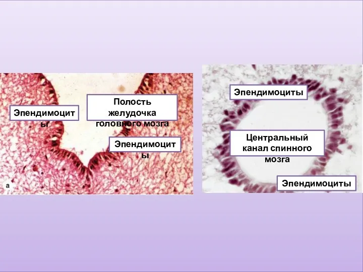 Эпендимоциты Эпендимоциты Центральный канал спинного мозга Эпендимоциты Эпендимоциты Полость желудочка головного мозга