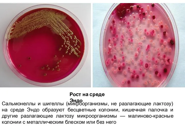 Рост на среде Эндо Сальмонеллы и шигеллы (микроорганизмы, не разлагающие