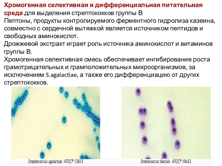 Хромогенная селективная и дифференциальная питательная среда для выделения стрептококков группы