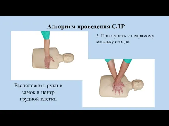 Алгоритм проведения СЛР 5. Приступить к непрямому массажу сердца Расположить