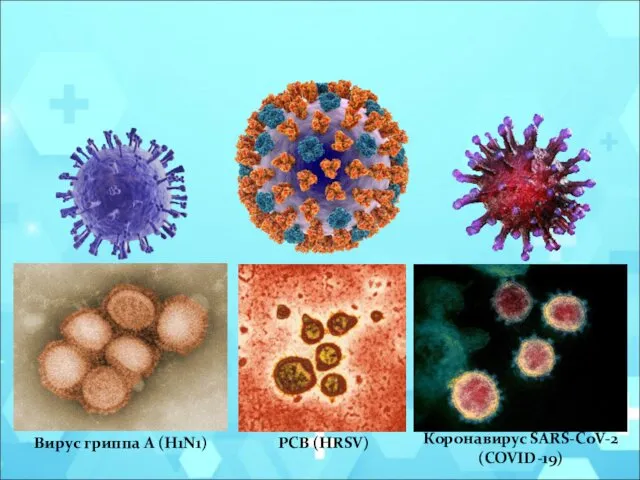 Вирус гриппа A (H1N1) Коронавирус SARS-CoV-2 (COVID-19) РСВ (HRSV)