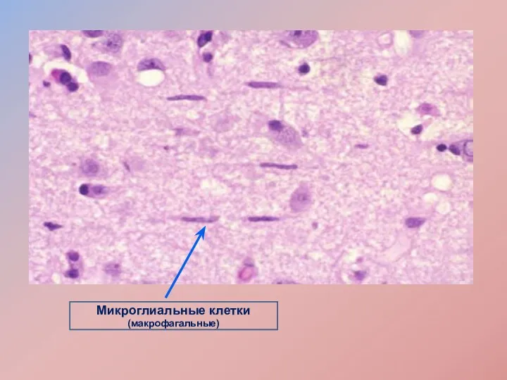 Микроглиальные клетки (макрофагальные)