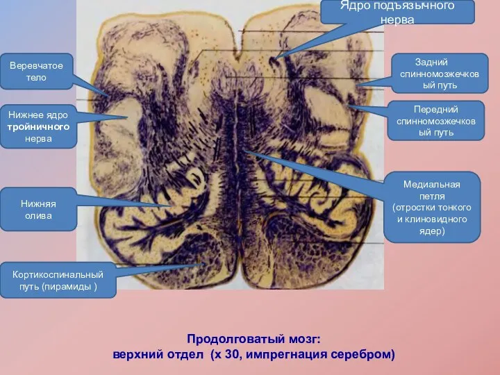 Продолговатый мозг: верхний отдел (х 30, импрегнация серебром) Ядро подъязычного