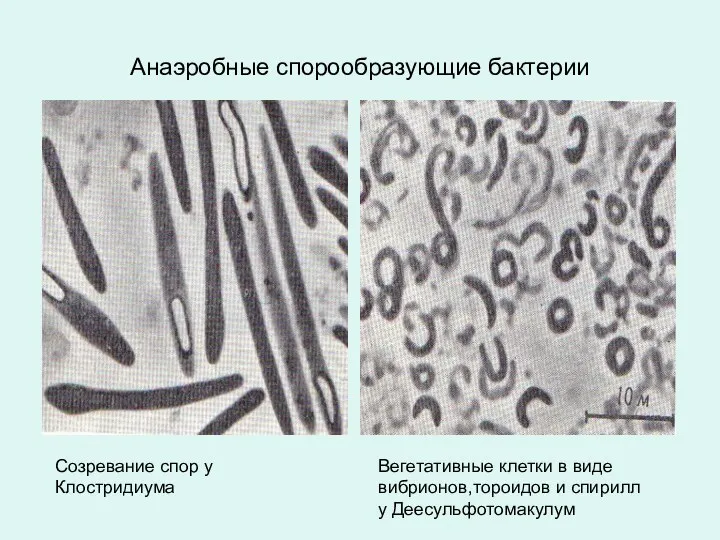 Анаэробные спорообразующие бактерии Созревание спор у Клостридиума Вегетативные клетки в виде вибрионов,тороидов и спирилл у Деесульфотомакулум