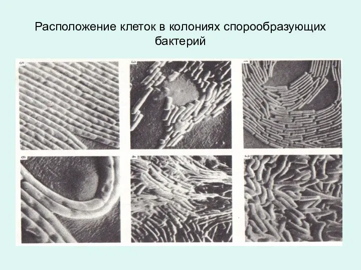 Расположение клеток в колониях спорообразующих бактерий
