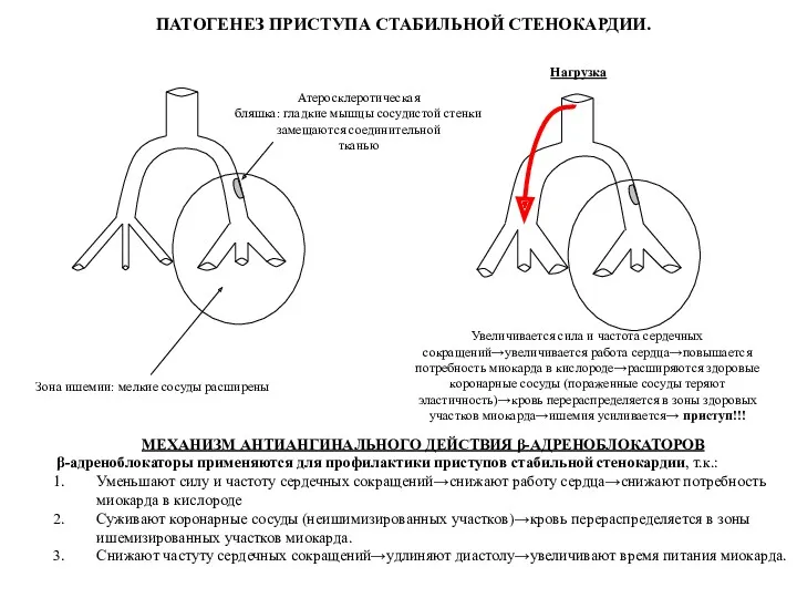 Атеросклеротическая бляшка: гладкие мышцы сосудистой стенки замещаются соединительной тканью Зона