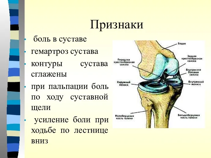 Признаки боль в суставе гемартроз сустава контуры сустава сглажены при