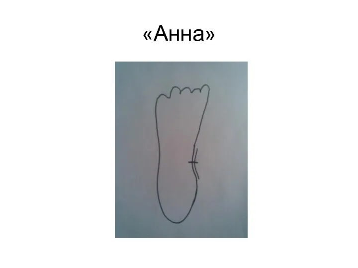 «Анна»