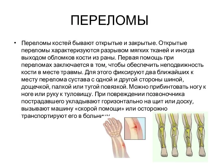 ПЕРЕЛОМЫ Переломы костей бывают открытые и закрытые. Открытые переломы характеризуются