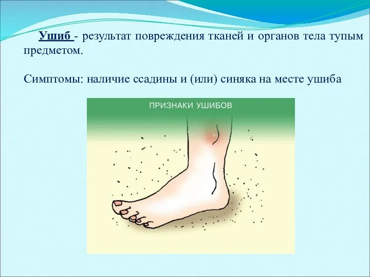 Ушиб - результат повреждения тканей и органов тела тупым предметом.