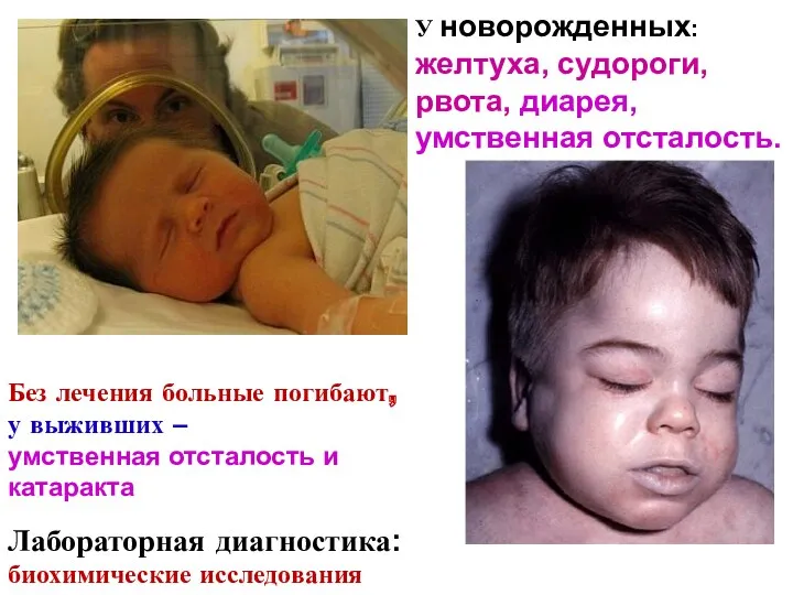 У новорожденных: желтуха, судороги, рвота, диарея, умственная отсталость. Без лечения