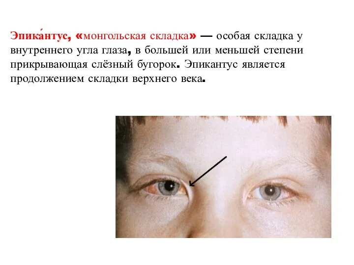 Эпика́нтус, «монгольская складка» — особая складка у внутреннего угла глаза,