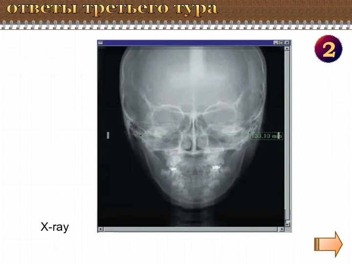 2 ответы третьего тура X-ray