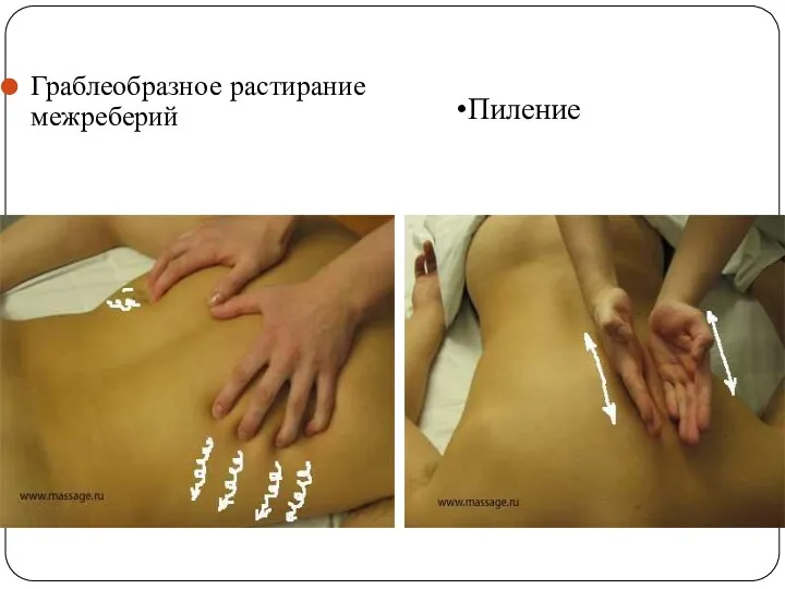 Граблеобразное растирание межреберий Пиление