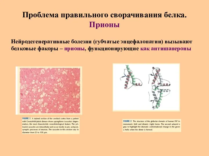 Проблема правильного сворачивания белка. Прионы Нейродегенеративные болезни (губчатые энцефалопатии) вызывают