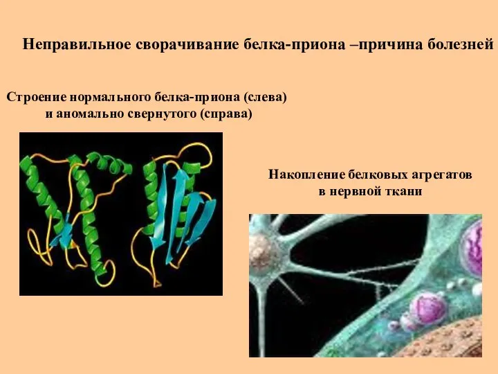 Неправильное сворачивание белка-приона –причина болезней Накопление белковых агрегатов в нервной