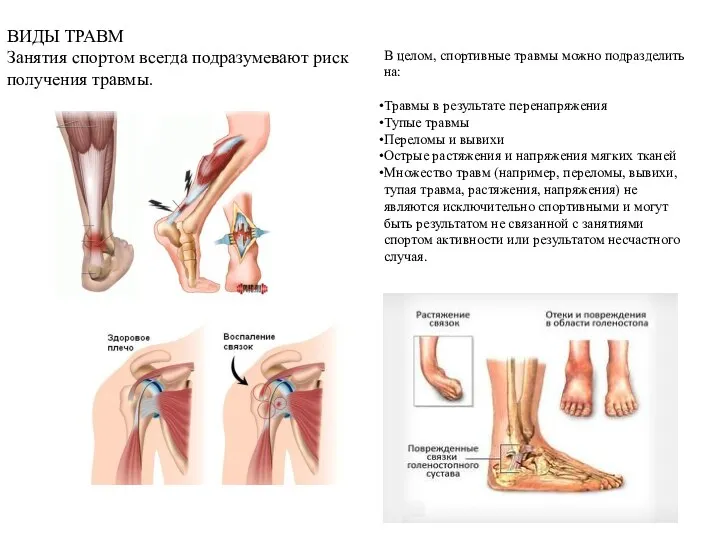 В целом, спортивные травмы можно подразделить на: Травмы в результате