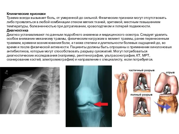 Клинические признаки Травма всегда вызывает боль, от умеренной до сильной.