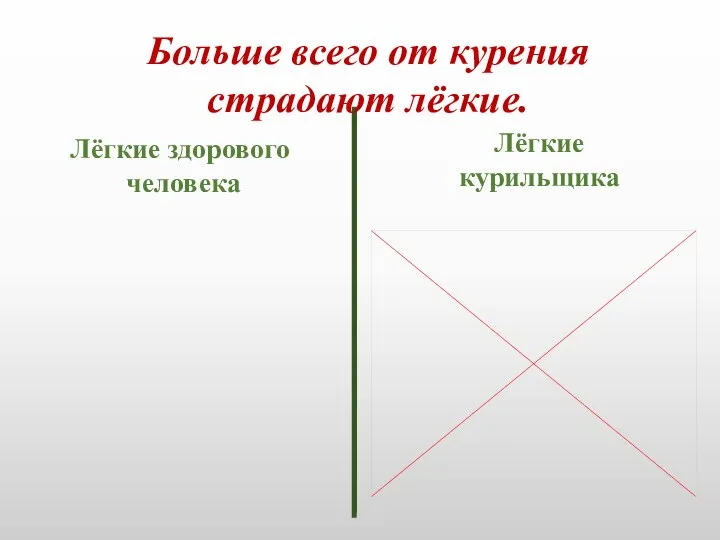 Лёгкие здорового человека Лёгкие курильщика Больше всего от курения страдают лёгкие.