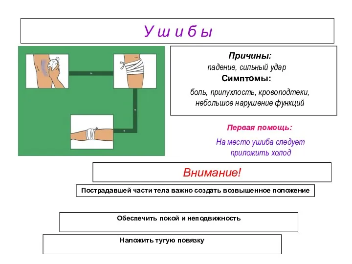 У ш и б ы Внимание! падение, сильный удар Причины: