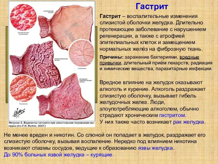 Вредное влияние на желудок оказывают алкоголь и курение. Алкоголь раздражает