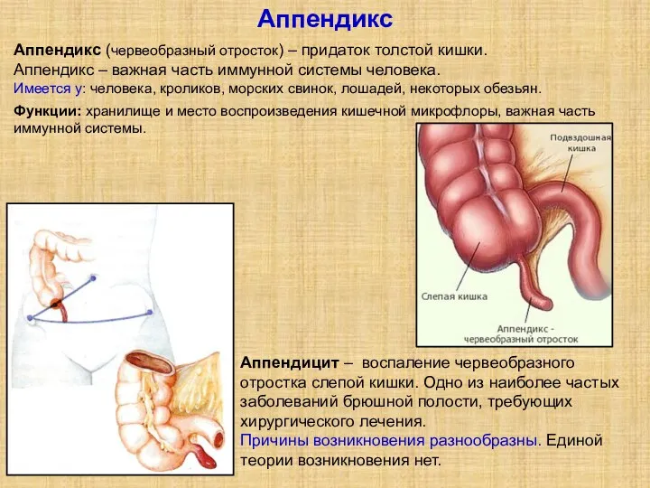 Аппендикс Аппендицит – воспаление червеобразного отростка слепой кишки. Одно из