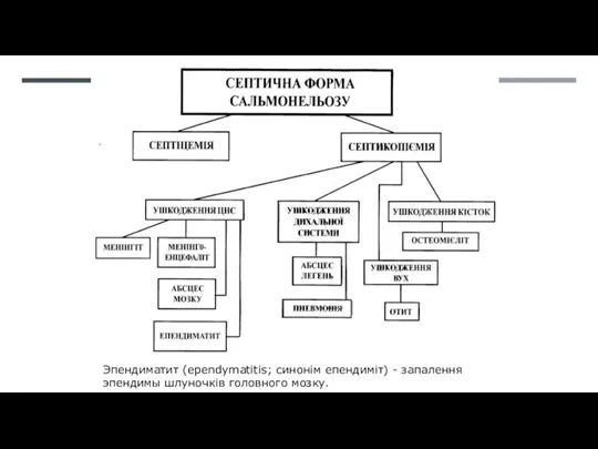 Эпендиматит (ependymatitis; синонім епендиміт) - запалення эпендимы шлуночків головного мозку.