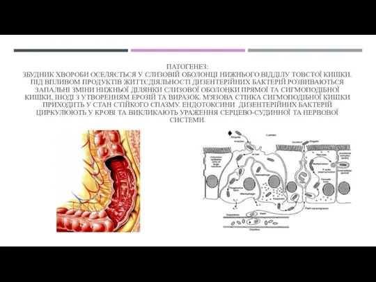 ПАТОГЕНЕЗ: ЗБУДНИК ХВОРОБИ ОСЕЛЯЄТЬСЯ У СЛИЗОВІЙ ОБОЛОНЦІ НИЖНЬОГО ВІДДІЛУ ТОВСТОЇ