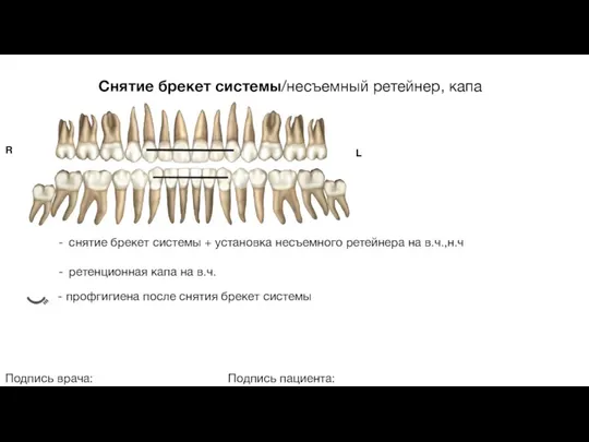 Снятие брекет системы/несъемный ретейнер, капа Подпись врача: Подпись пациента: R