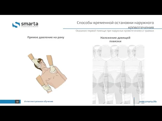 Способы временной остановки наружного кровотечения Оказание первой помощи при наружных