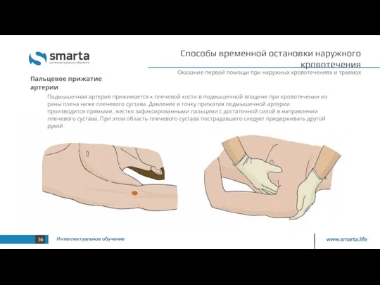 Оказание первой помощи при наружных кровотечениях и травмах Подмышечная артерия