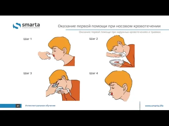 Оказание первой помощи при носовом кровотечении Оказание первой помощи при