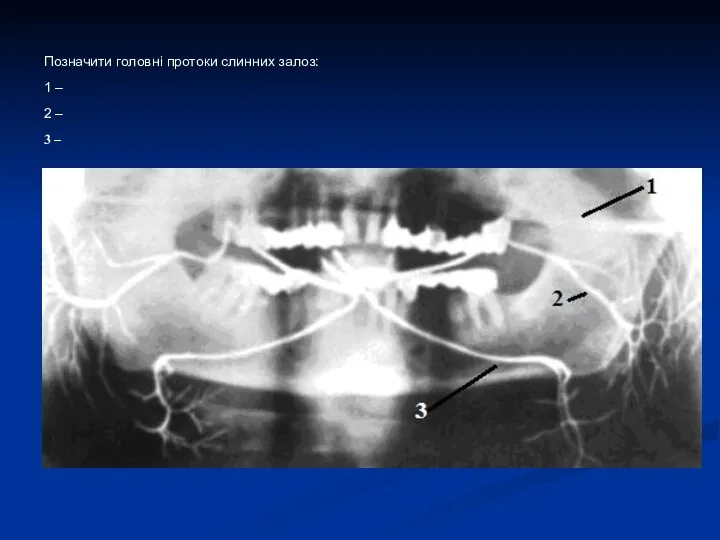 Позначити головні протоки слинних залоз: 1 – 2 – 3 –