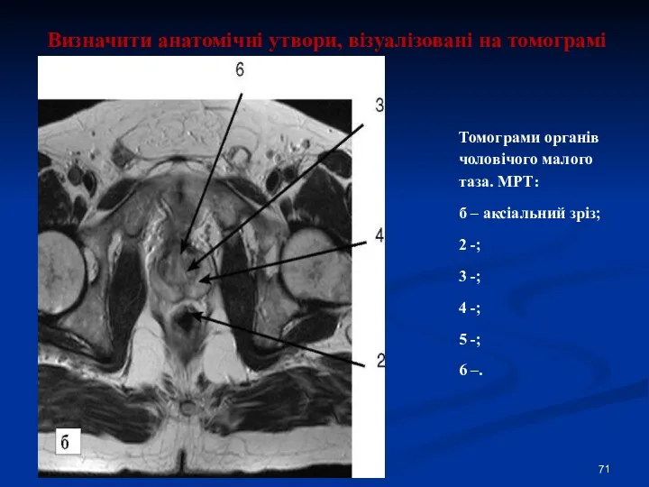 Визначити анатомічні утвори, візуалізовані на томограмі Томограми органів чоловічого малого