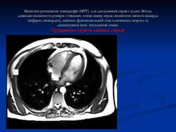 Магнітно-резонансна томографія (МРТ) для дослідження серця і судин. Метод дозволяє: