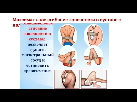 Максимальное сгибание конечности в суставе с валиком