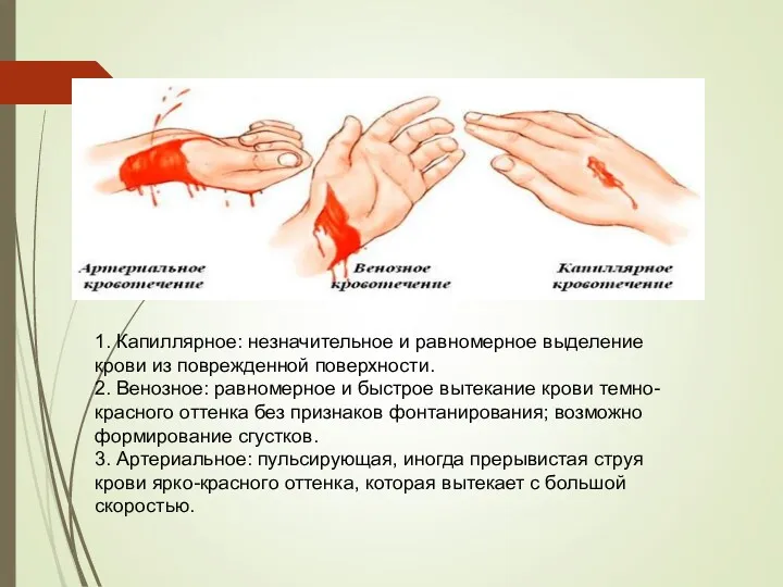 1. Капиллярное: незначительное и равномерное выделение крови из поврежденной поверхности. 2. Венозное: равномерное