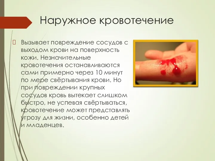 Наружное кровотечение Вызывает повреждение сосудов с выходом крови на поверхность