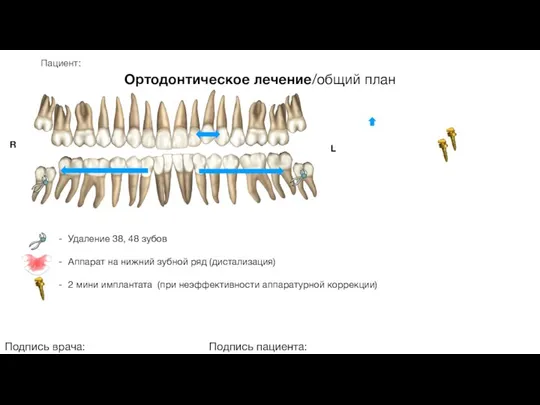 Пациент: Ортодонтическое лечение/общий план Подпись врача: Подпись пациента: R L