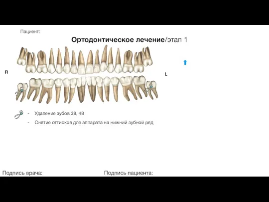 Пациент: Ортодонтическое лечение/этап 1 Подпись врача: Подпись пациента: R L