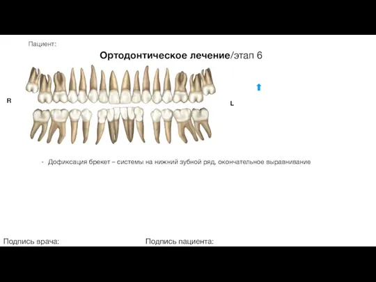 Пациент: Ортодонтическое лечение/этап 6 Подпись врача: Подпись пациента: R L