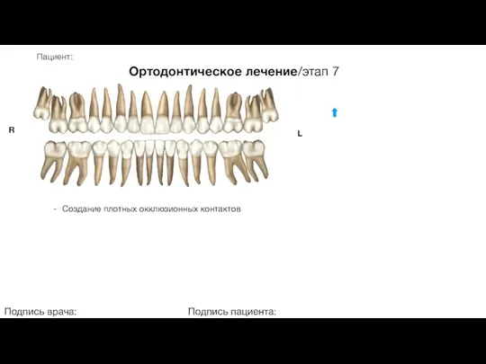 Пациент: Ортодонтическое лечение/этап 7 Подпись врача: Подпись пациента: R L Создание плотных окклюзионных контактов