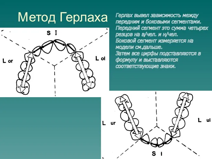 Метод Герлаха Герлах вывел зависимость между передним и боковыми сегментами.