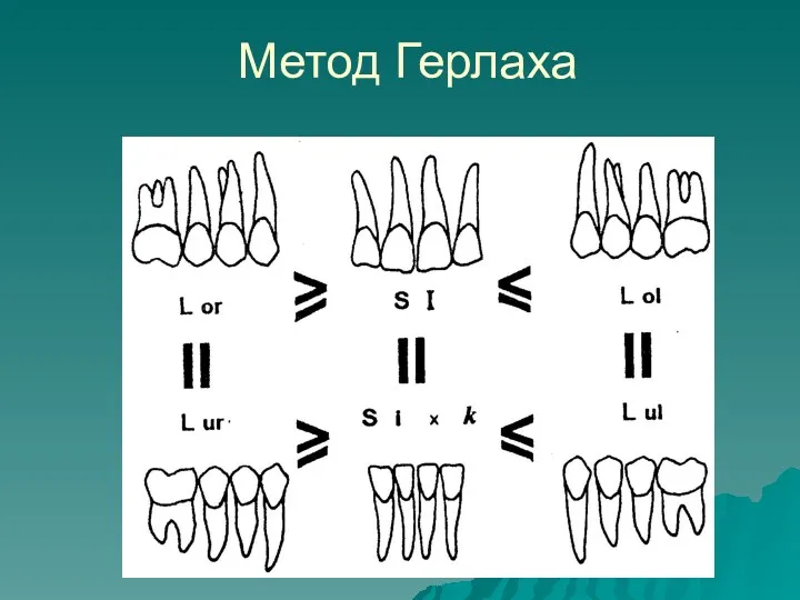 Метод Герлаха