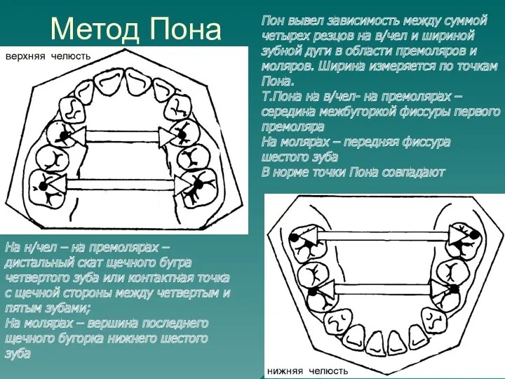 Метод Пона Пон вывел зависимость между суммой четырех резцов на